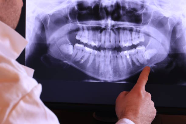 Urgent Tooth Repair in WI