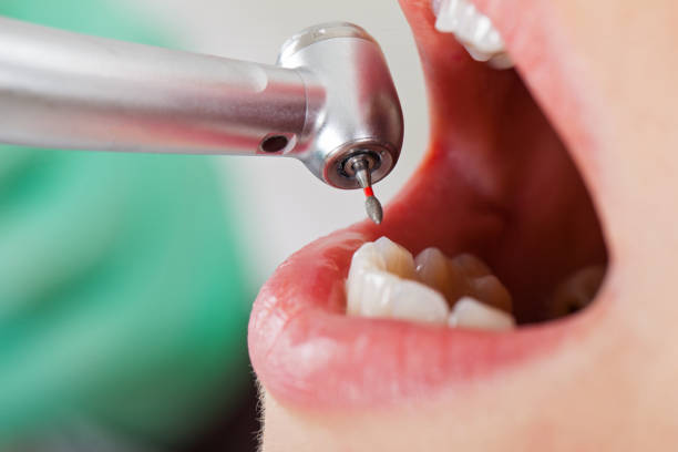 Best Teeth Whitening  in Maple Bluff, WI